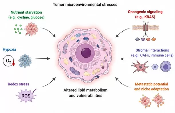 lipid metabolism stress conditions pancreatic cancer metabolic vulnerabilities
